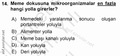 Soru 14