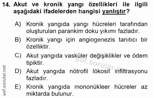 Soru 14