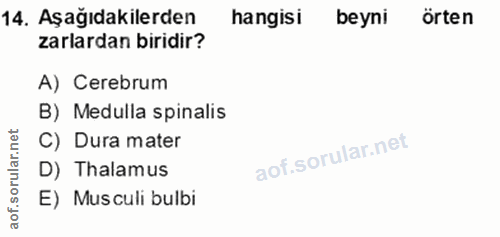Soru 14