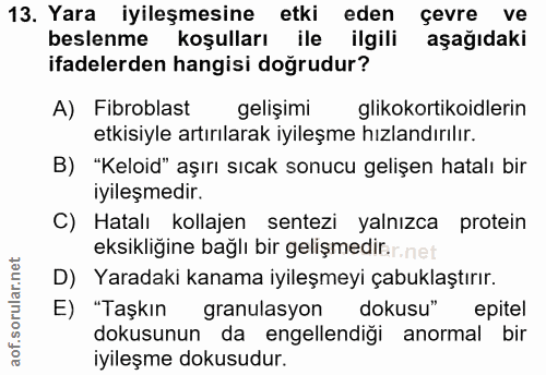 Soru 13