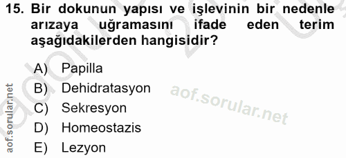 Soru 15