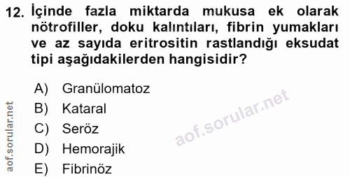 Soru 12