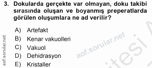 Soru 3