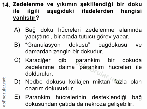 Soru 14