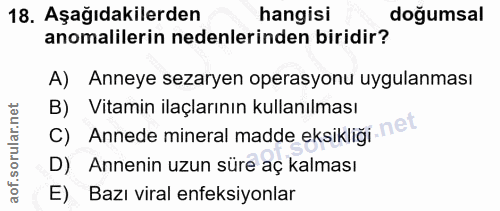 Soru 18