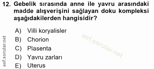 Soru 12