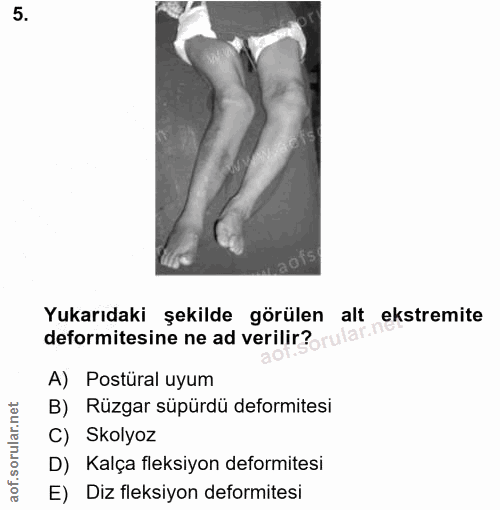 Soru 5