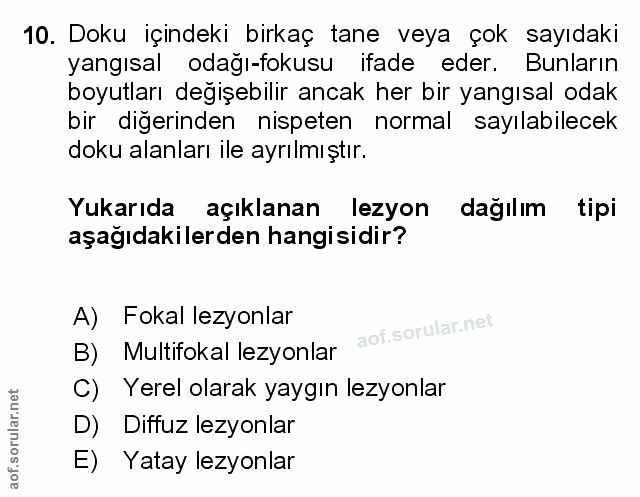 Soru 10