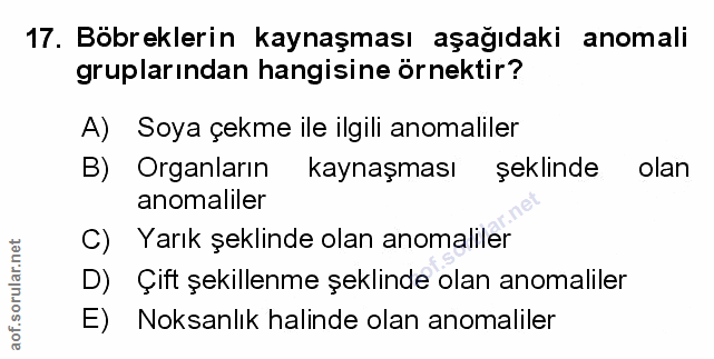 Soru 17