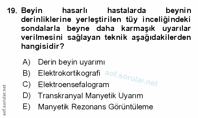 Soru 19