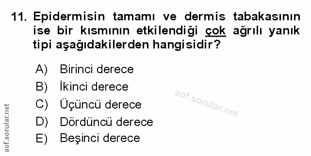 Soru 11