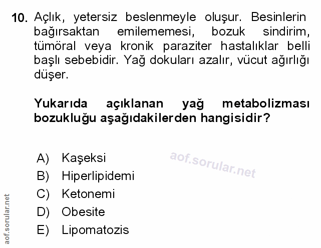 Soru 10