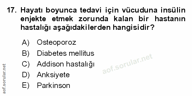 Soru 17