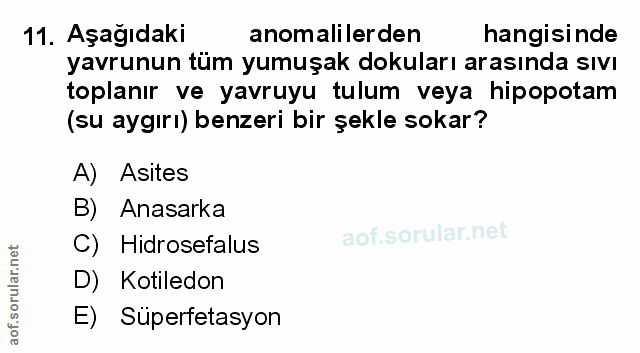 Soru 11