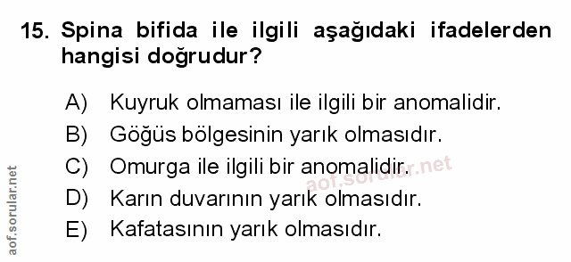 Soru 15
