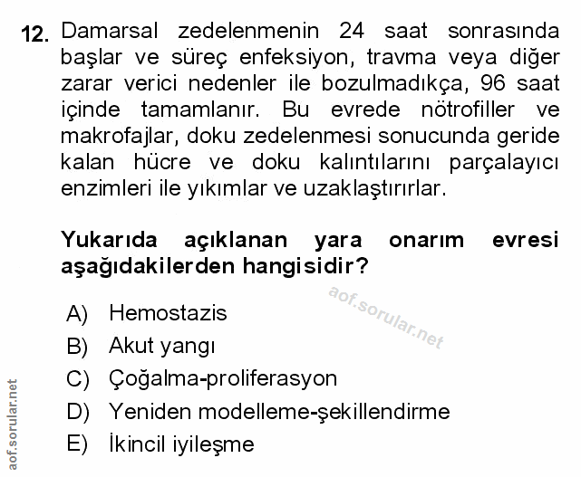 Soru 12