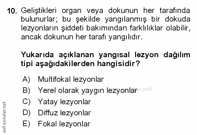 Soru 10