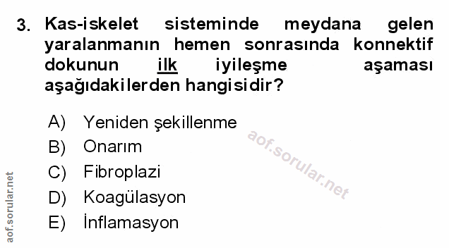 Soru 3