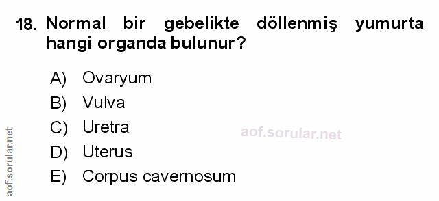 Soru 18