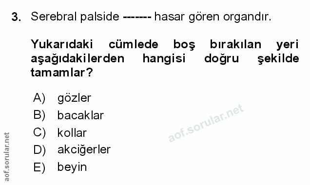 Soru 3