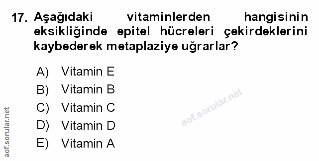 Soru 17