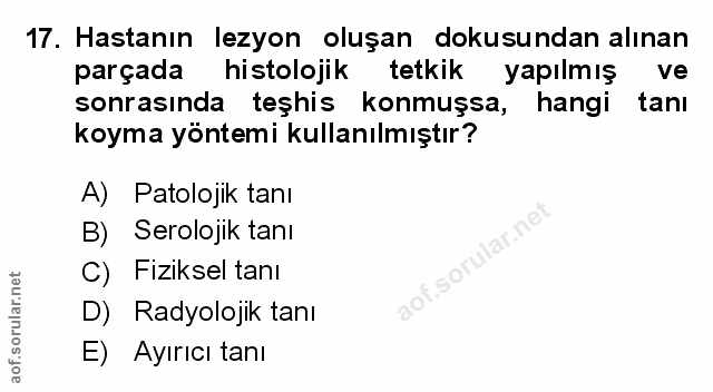 Soru 17