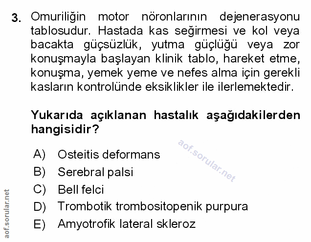 Soru 3