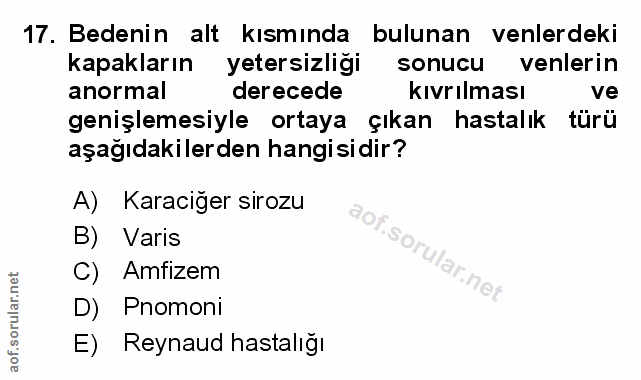 Soru 17