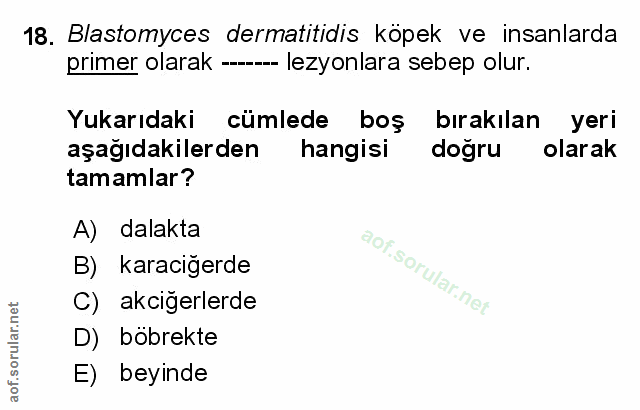 Soru 18