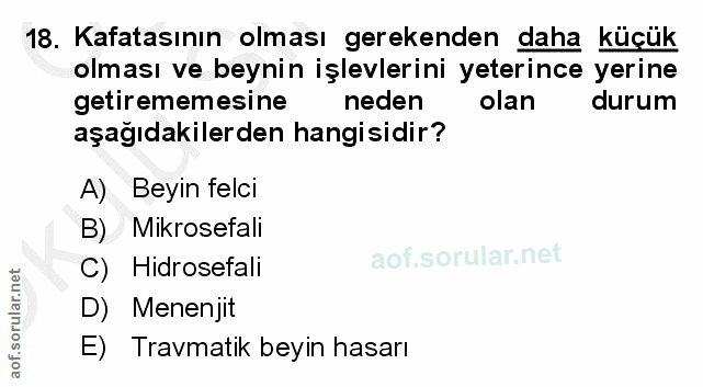 Soru 18