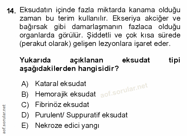 Soru 14