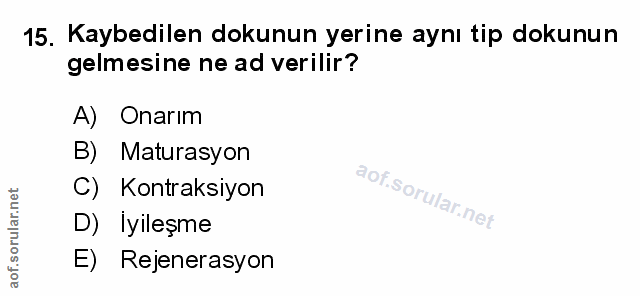 Soru 15