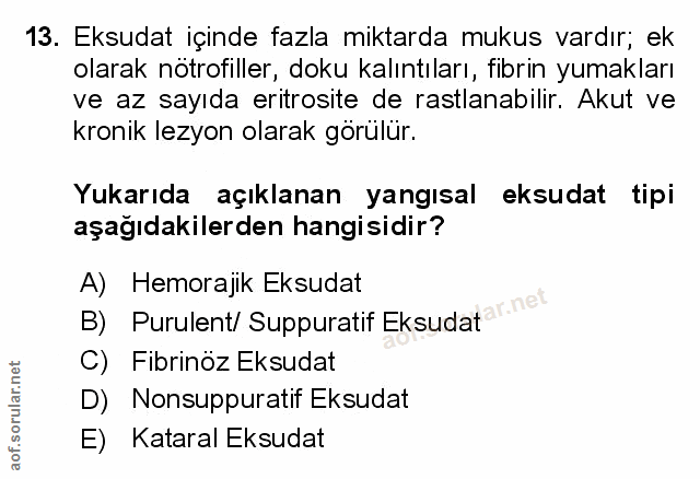 Soru 13
