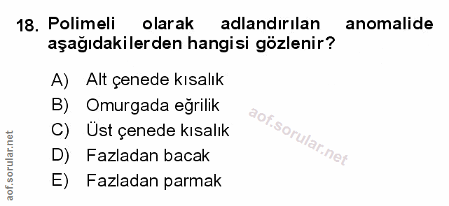 Soru 18