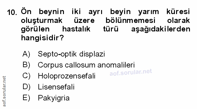Soru 10