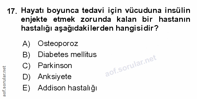 Soru 17