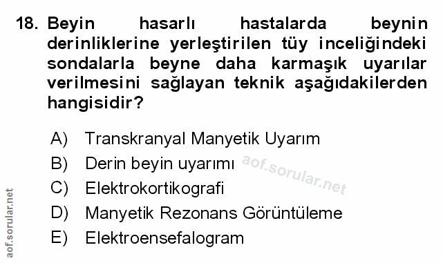 Soru 18