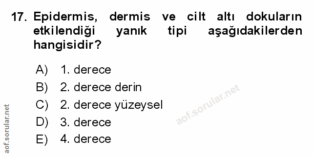 Soru 17