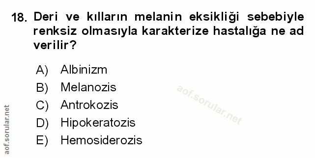 Soru 18