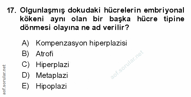 Soru 17