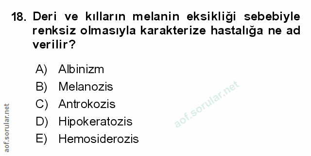 Soru 18