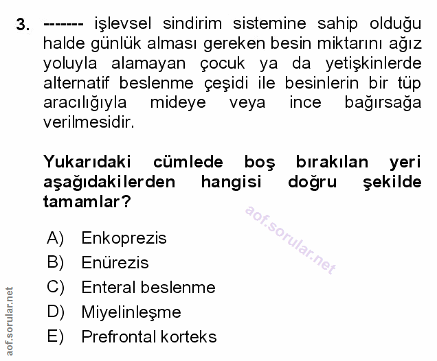 Soru 3