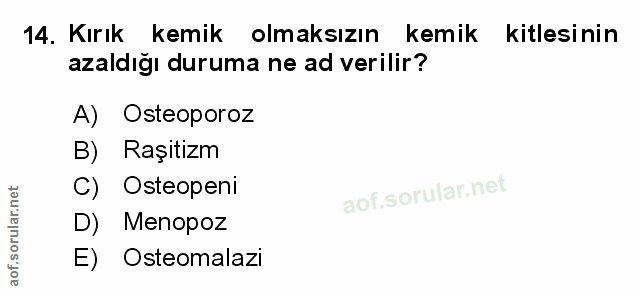 Soru 14