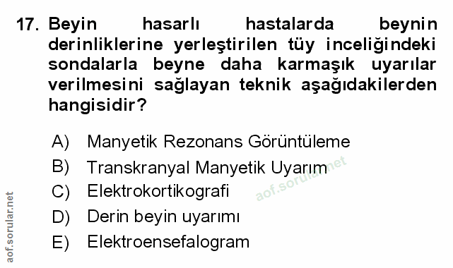 Soru 17