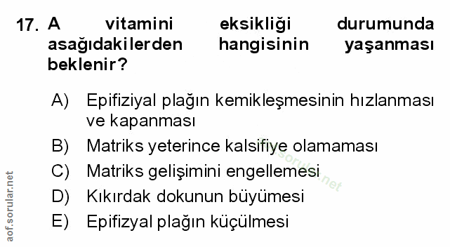 Soru 17