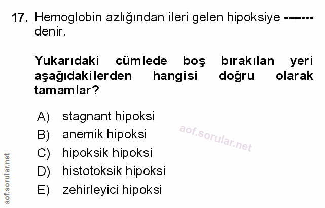 Soru 17
