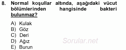 Hijyen ve Sanitasyon 2014 - 2015 Tek Ders Sınavı 8.Soru