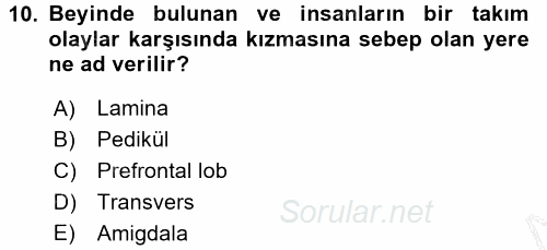 Etkili İletişim Teknikleri 2016 - 2017 Ara Sınavı 10.Soru