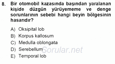 Çocuk Ruh Sağlığı 2012 - 2013 Ara Sınavı 8.Soru